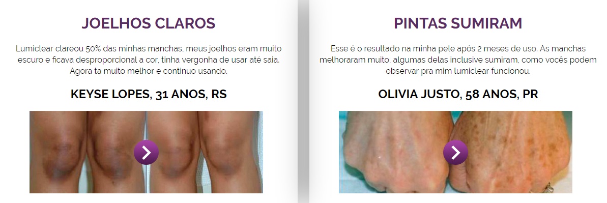lumiclear resultados antes e depois 1