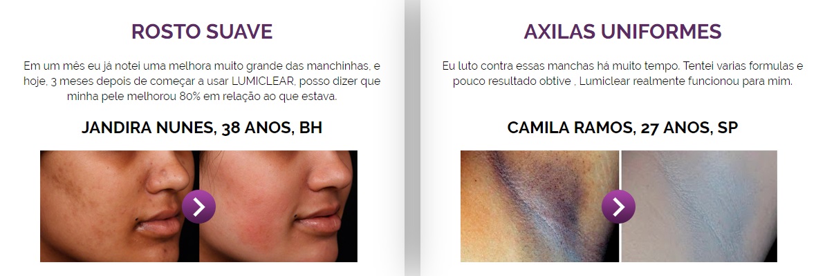 lumiclear resultados antes e depois
