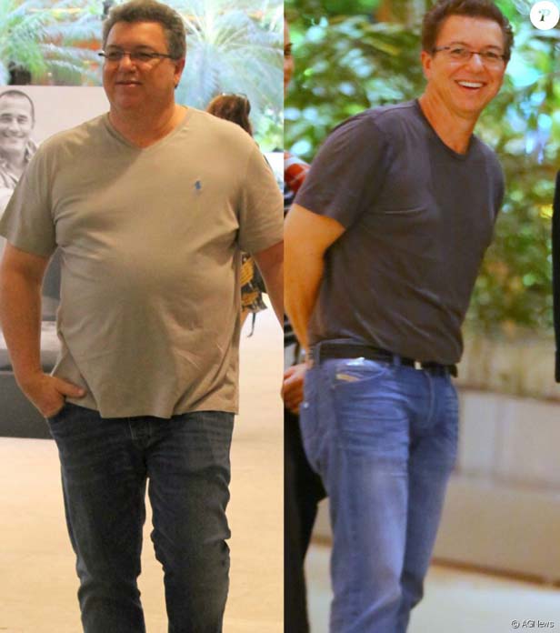 Antes e depois da cirurgia bariátrica